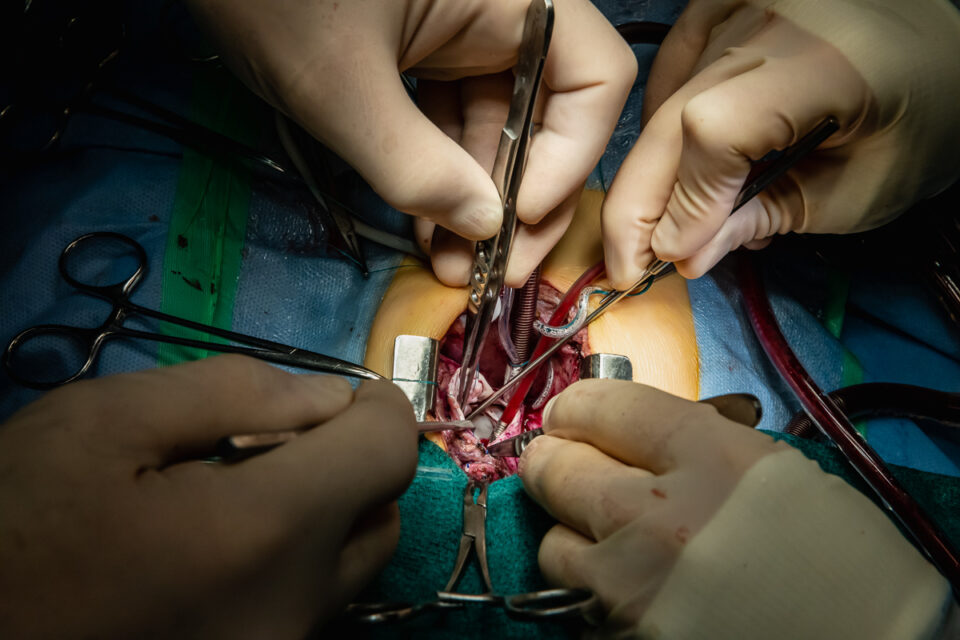 Ziekenhuis reportage, zorgfotografie, een open hart tijdens een openhartoperatie, foto door Sandra Stokmans Fotografie