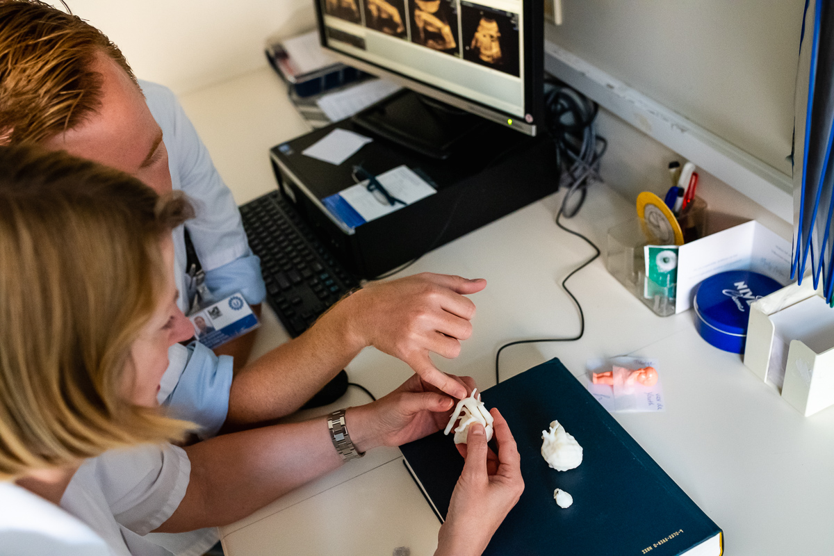 Het 3D-geprint hartje vanuit de eerste foetale MRI-scan.