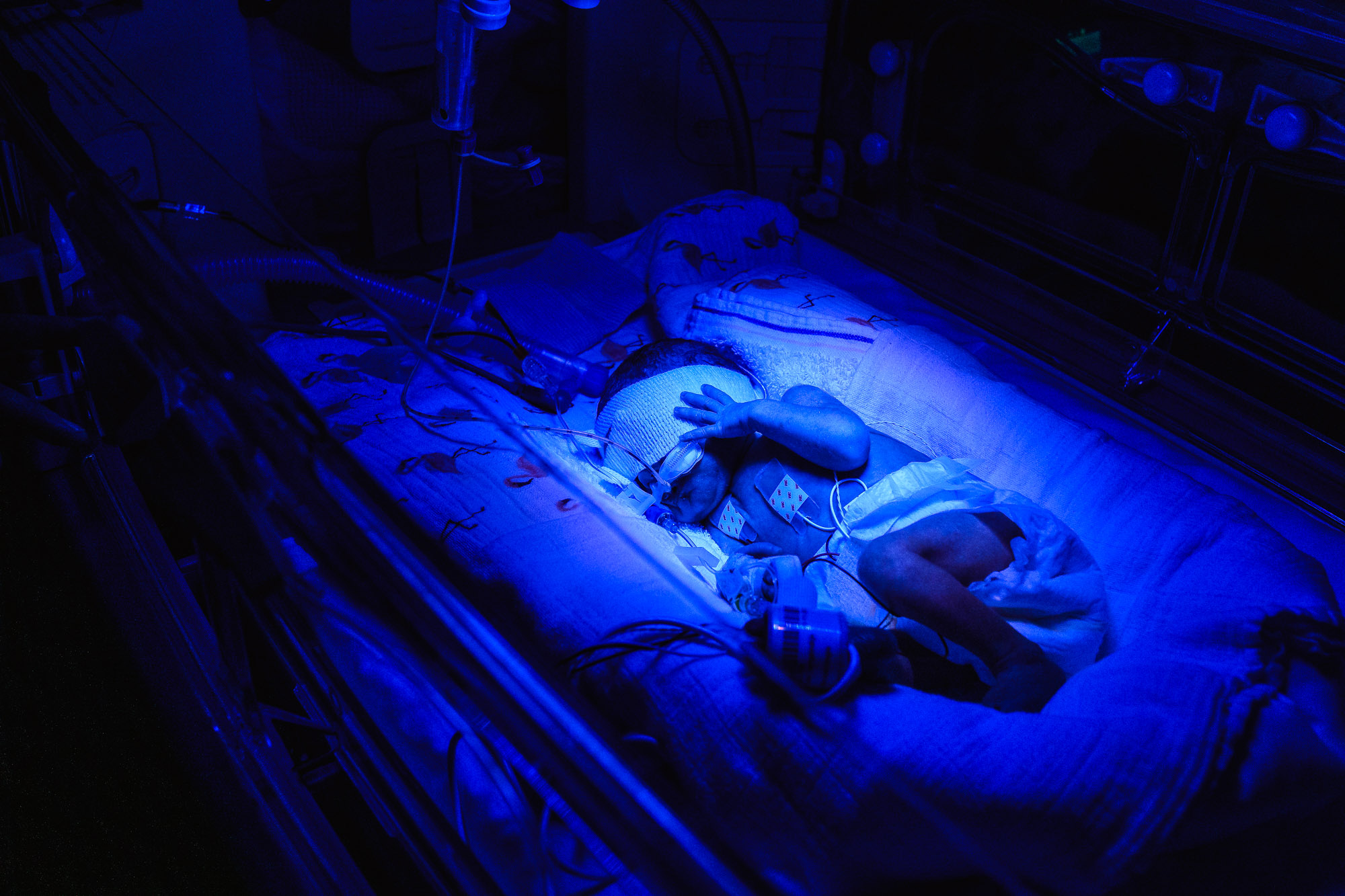 Tijdens de zorg reportage in de NICU, voor de beeldbank van het WKZ, zag ik een premature baby lichttherapie ondergaan. 